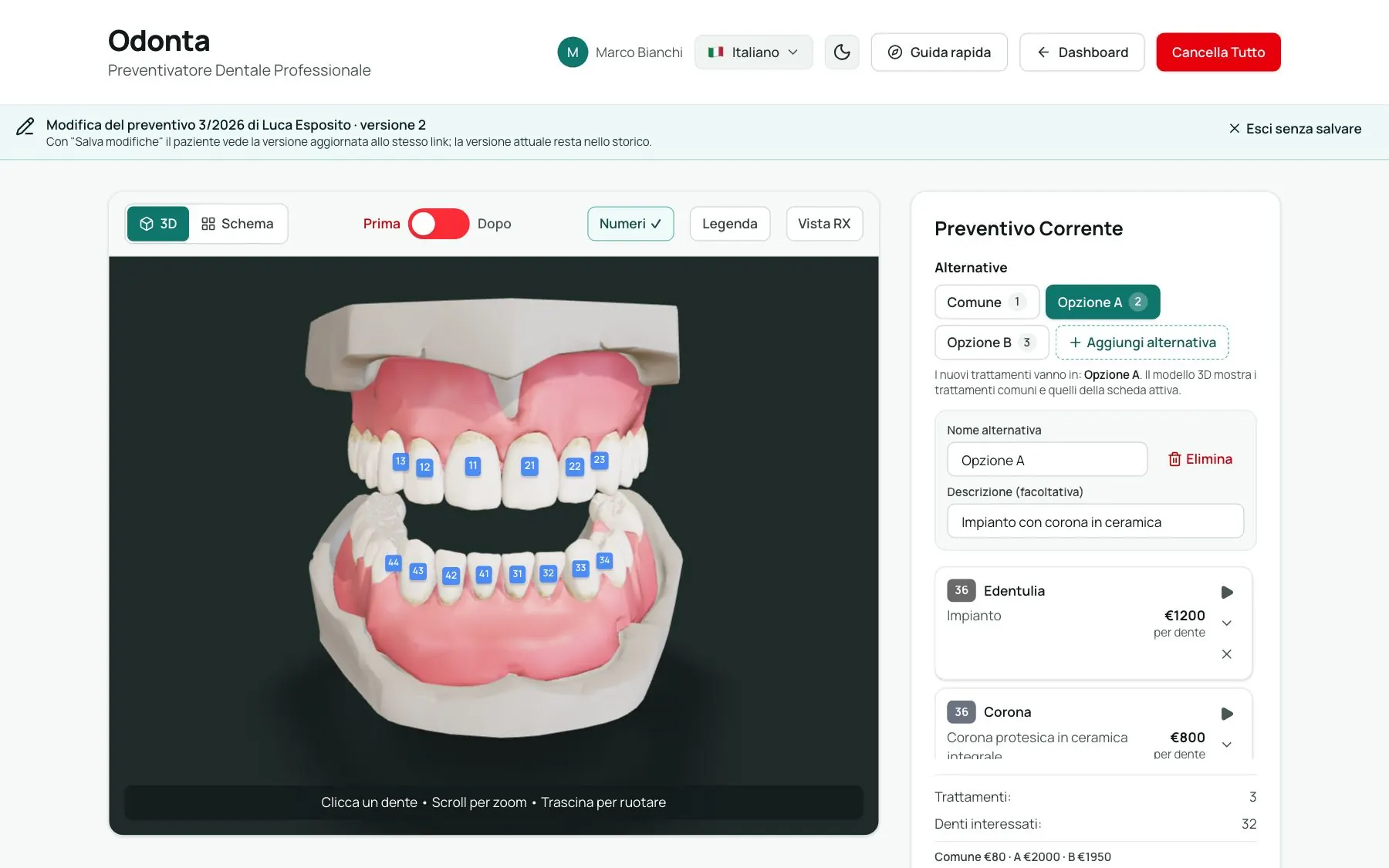Preventivatore 3D di Odonta con le alternative di trattamento
