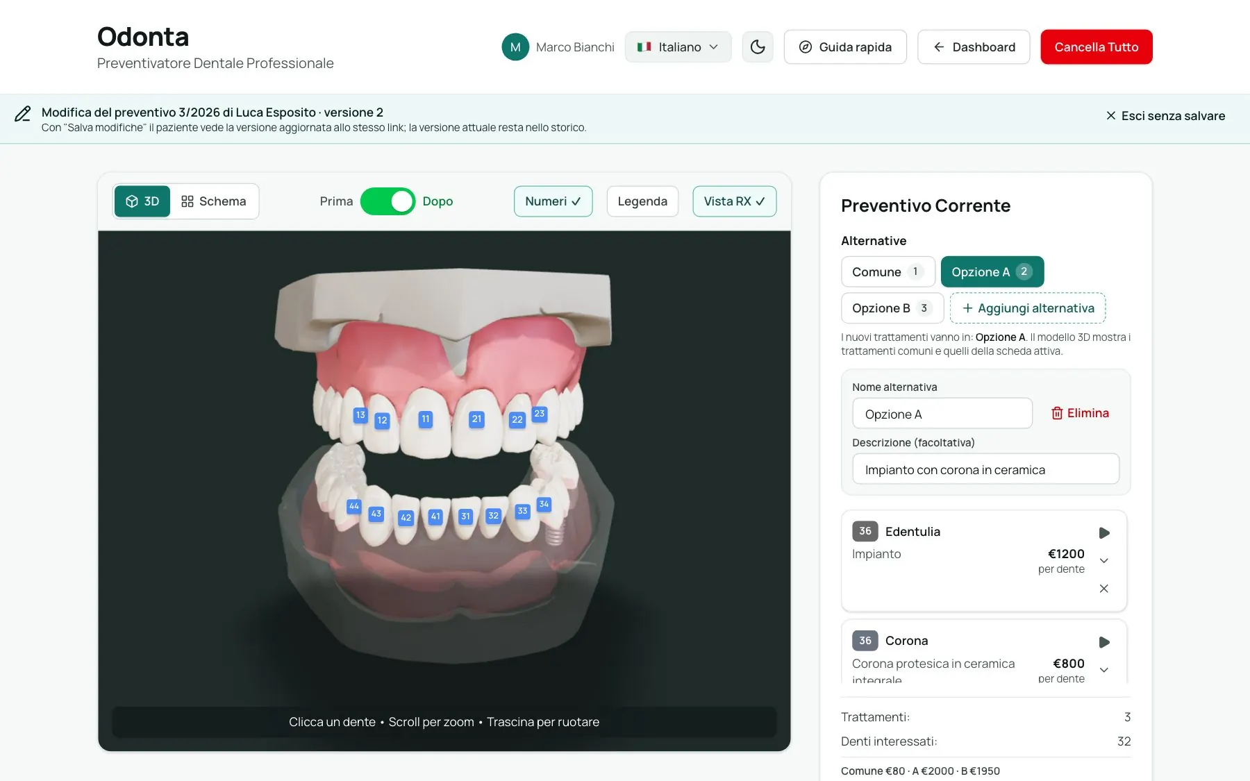 Preventivatore 3D di Odonta con vista RX e alternative di trattamento