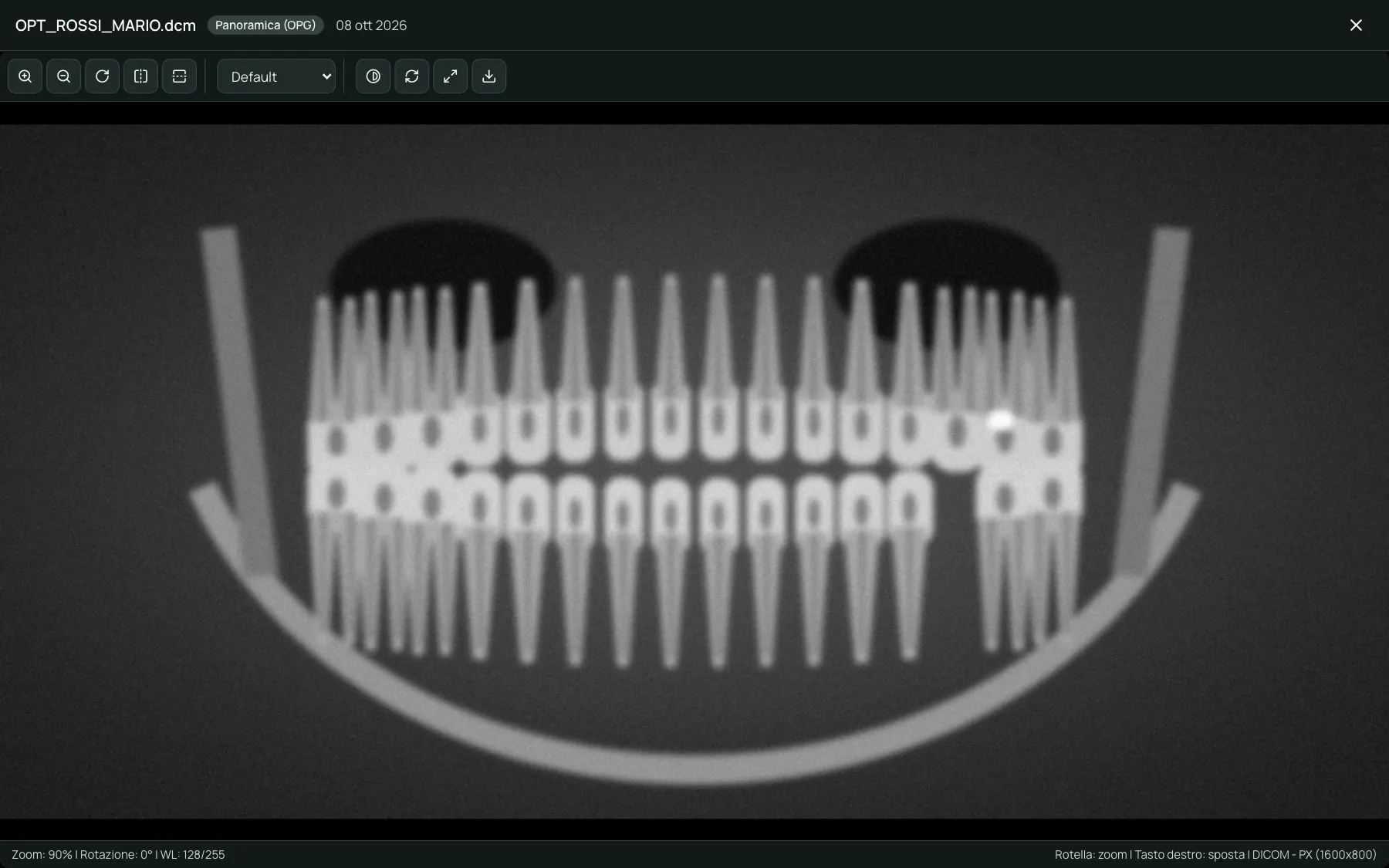 Visualizzatore delle radiografie