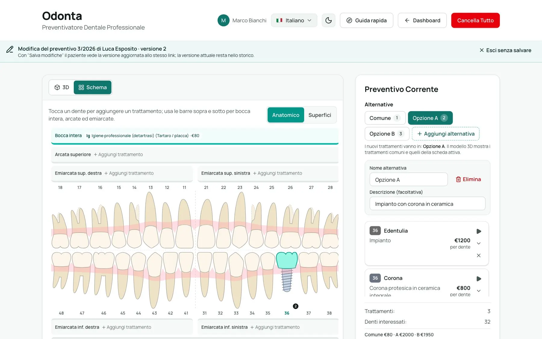 Schema anatomico dei denti nel preventivatore
